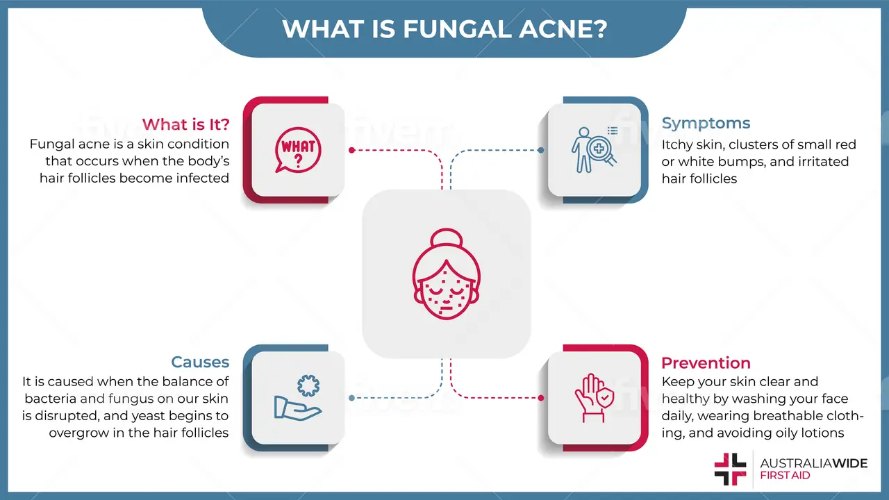 Infographic on Fungal Acne Causes, Symptoms, and Treatment